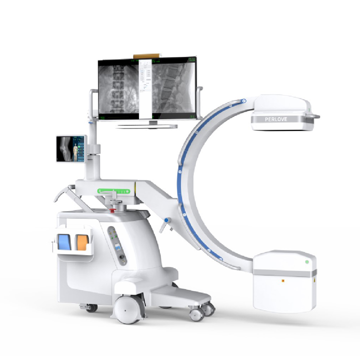 什么是真正的C形臂？有哪些特点
