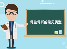 【医疗科普】骨盆骨折的常见类型有哪几种？