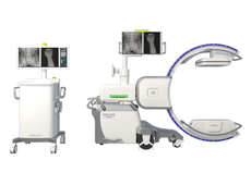什么是移动式三维C形臂？它的临床优势体现在哪？