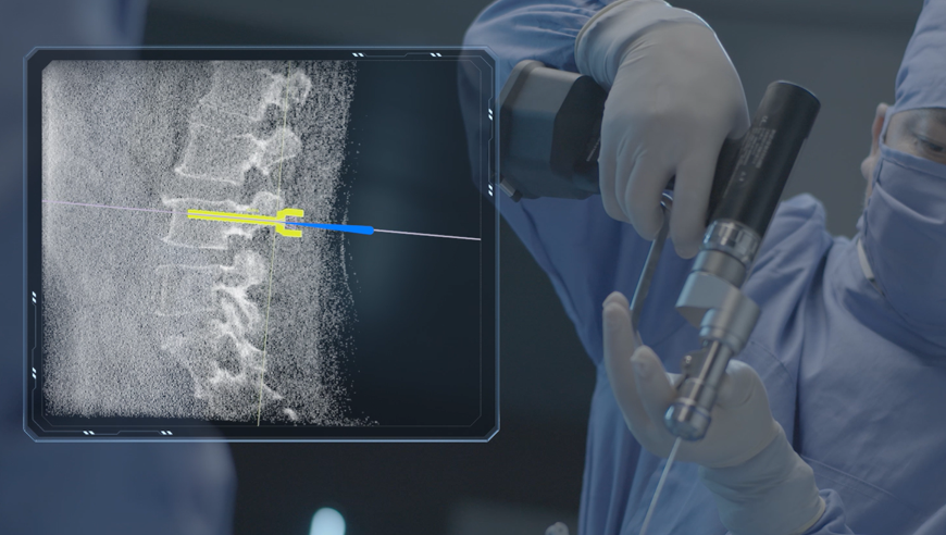 机器人做手术好还是医生做手术好，机器人做手术有哪些好处？