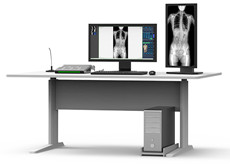 医院用什么设备拍片？会有辐射吗？