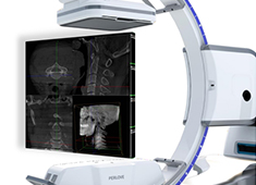 脊柱手术机器人二维和三维的区别是什么