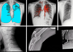 动态dr的辐射剂量是多少 相当于一次低剂量胸部CT