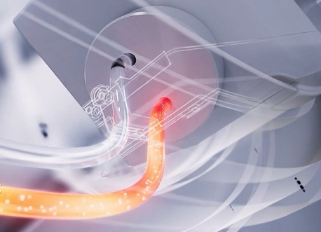 X线球管热容量是越大越好吗？