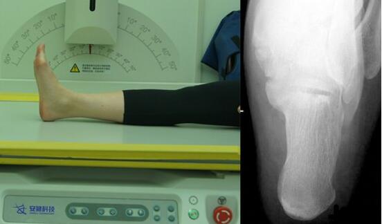 多功能动态DR 多功能动态DR