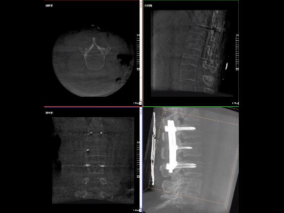 【医疗科普】2分钟带你了解高质量X光片的标准是什么？
