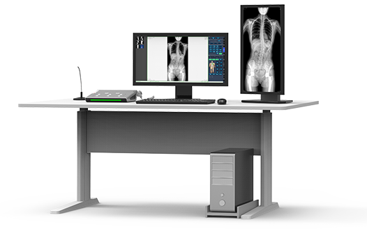 大视野平板动态DR全脊柱一次成像 大视野平板动态DR全脊柱一次成像