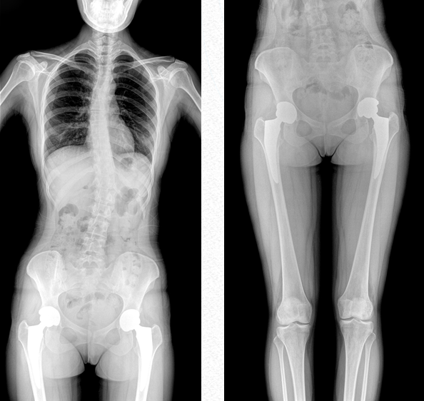 大视野平板动态DR 大视野平板动态DR