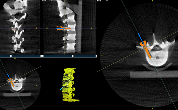 外科手术机器人3D影像 外科手术机器人3D影像