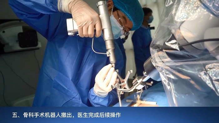 骨科手术机器人和医生分工5