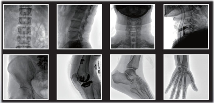 C形臂临床影像 C形臂临床影像