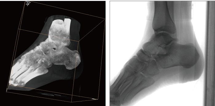 移动三维C形臂平板拍摄图像 移动三维C形臂平板拍摄图像