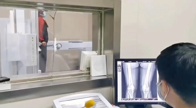 医用DR检查 医用DR检查