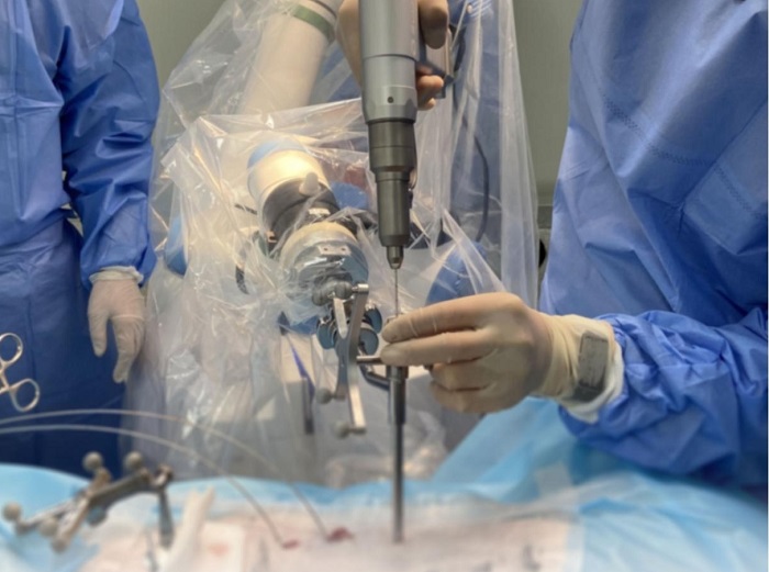 脊柱外科手术导航定位系统