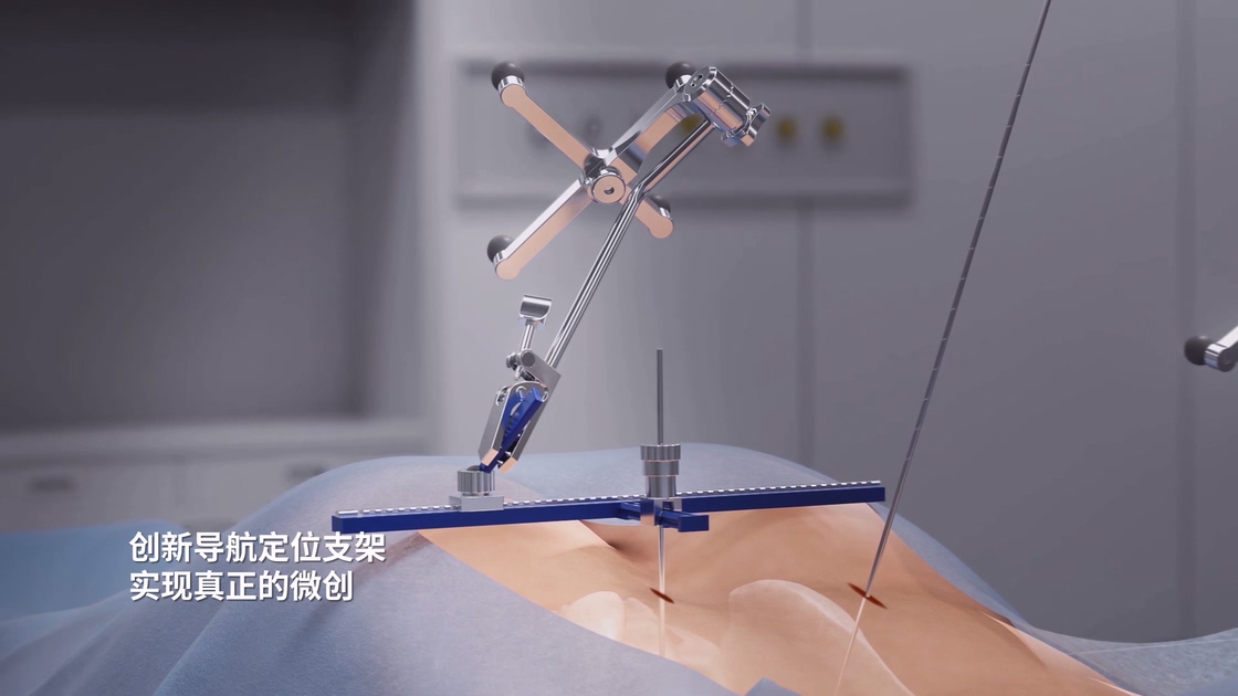 骨科手术机器人导航定位支架