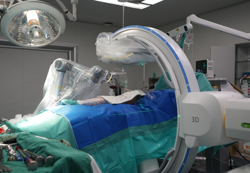 医院里的骨科手术机器人与三维C型臂