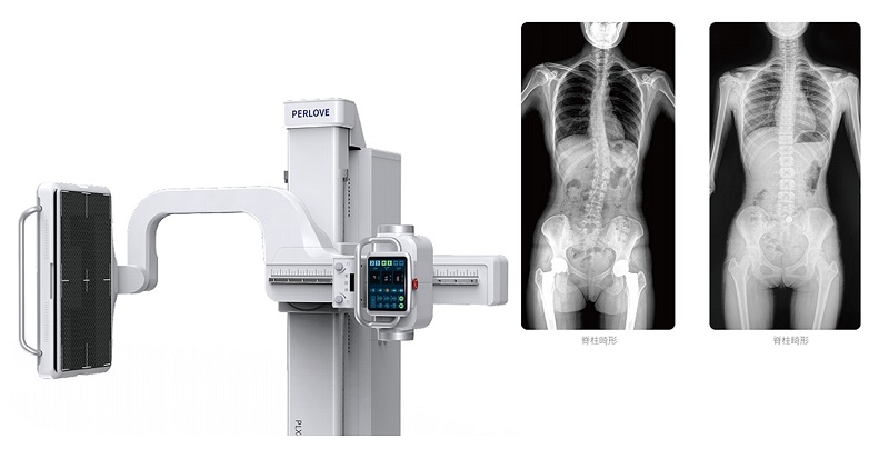 动态DR脊柱拍片